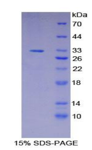 SDS-PAGE